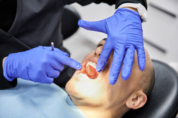 Best Emergency Wisdom Teeth Removal in Fresno, CA